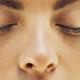 Non-surgical nose reshaping