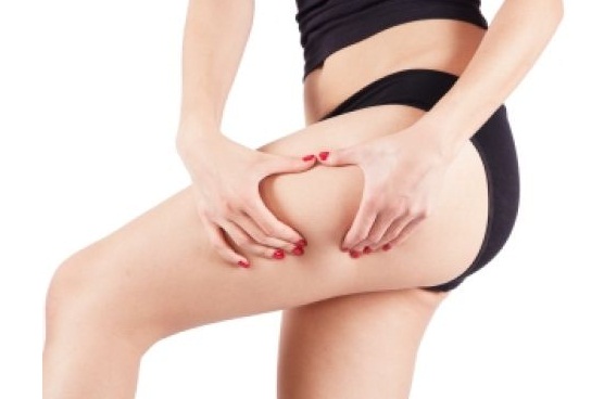 Cellfina — Advanced Dermatology
