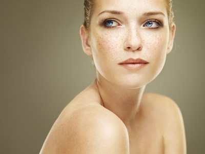 Age-Spots