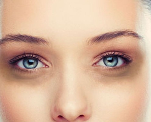 how-to-remove-dark-circles