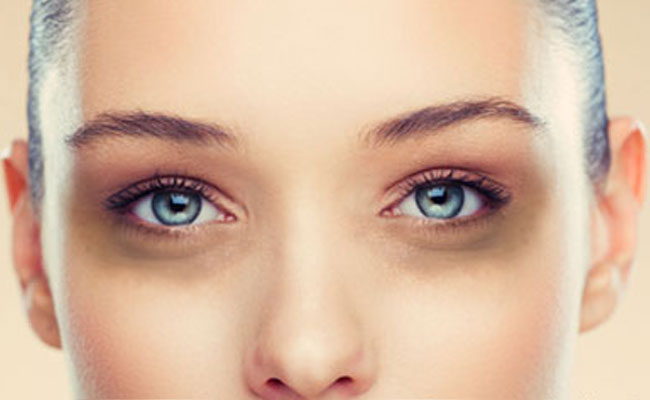 how to get rid of dark eye bags in the morning