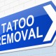 Tatoo-removal-cream