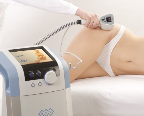 Exilis-Body-Treatment