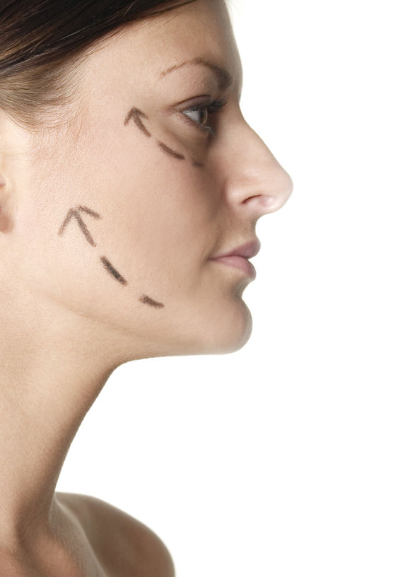 MACS Facelift — Advanced Dermatology