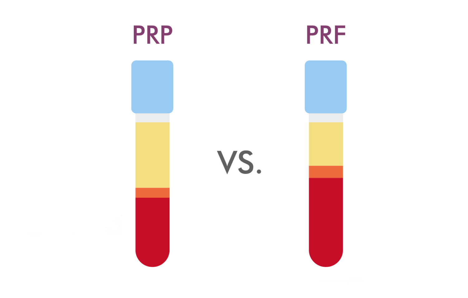 PRP vs. PRF Which is Better for Hair Loss?