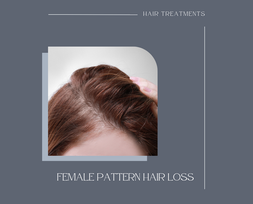 Female Pattern Hair Loss