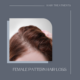 Female Pattern Hair Loss