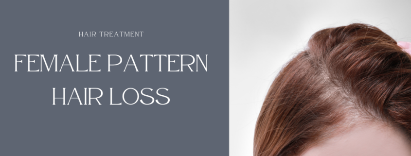 Female Pattern Hair Loss